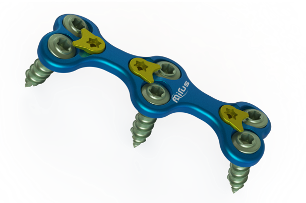 CYGNUS Anterior Cervical Plate CYGNUS Anterior Cervical Plate