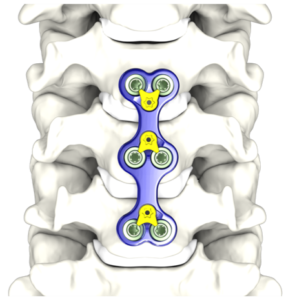 Cygnus on Spine F Cygnus on Spine F