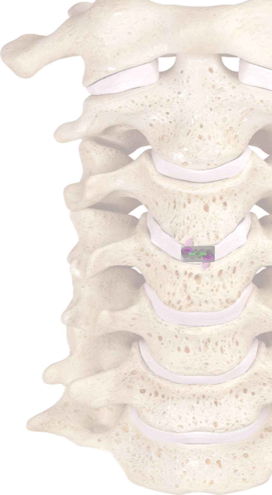 RIGEL in Spine RIGEL in Spine