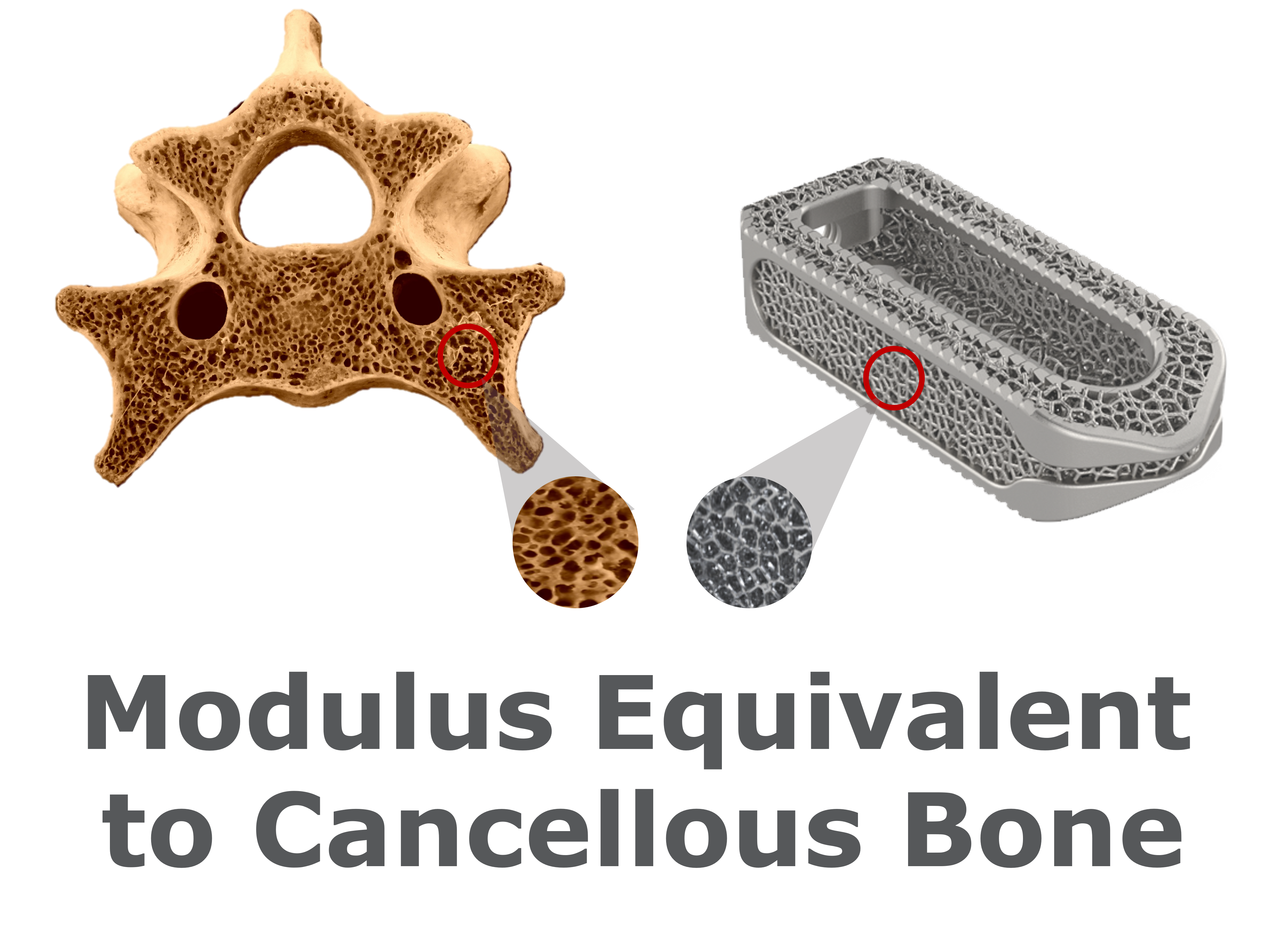 3DR Modulus Bone