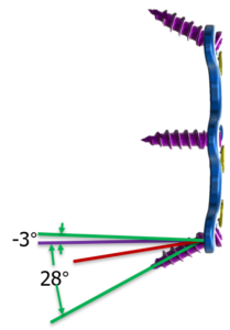 CYGNUS Anterior Cervical Plate system features2 CYGNUS Anterior Cervical Plate system features2
