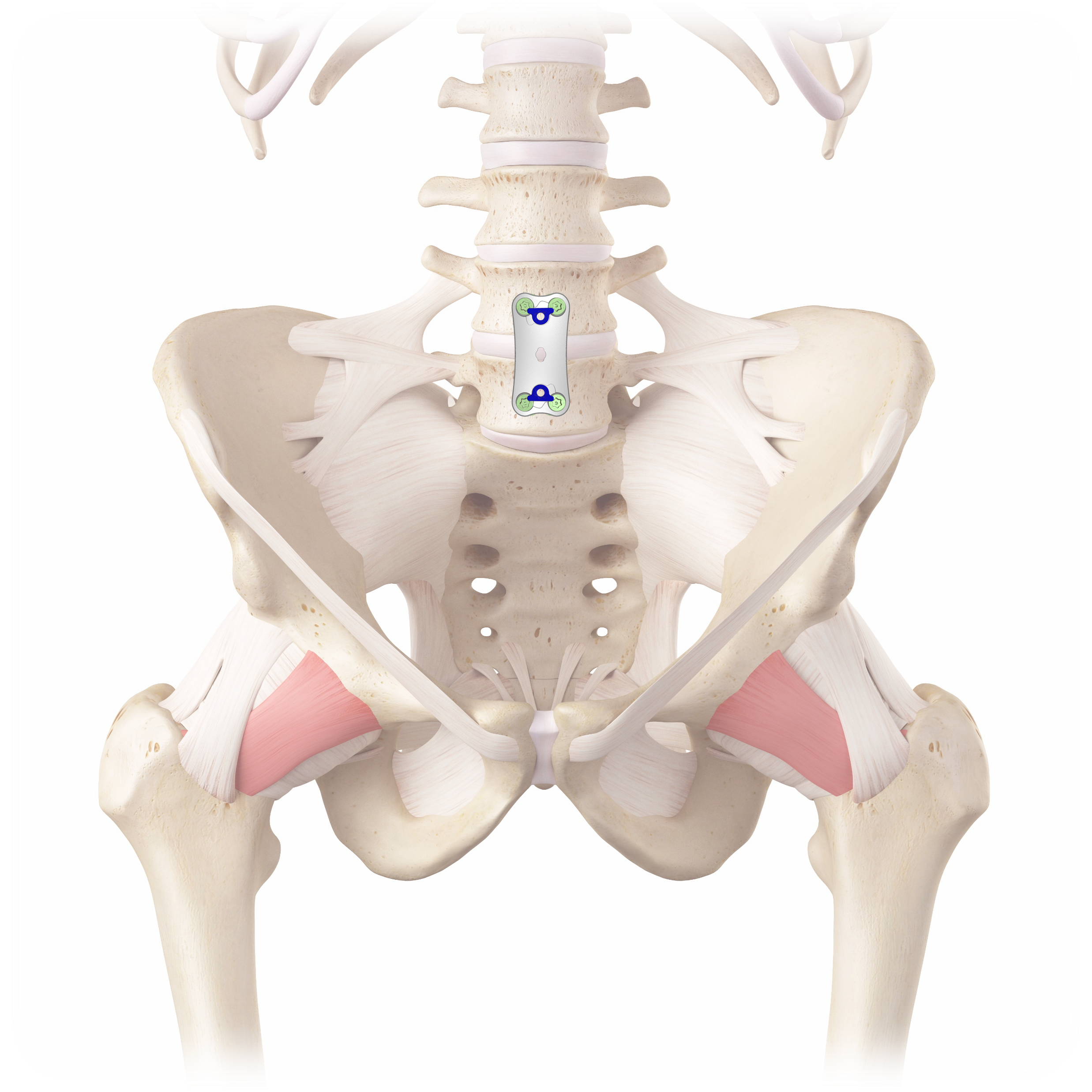 Anterior Plate on Spine 3 Anterior Plate on Spine 3